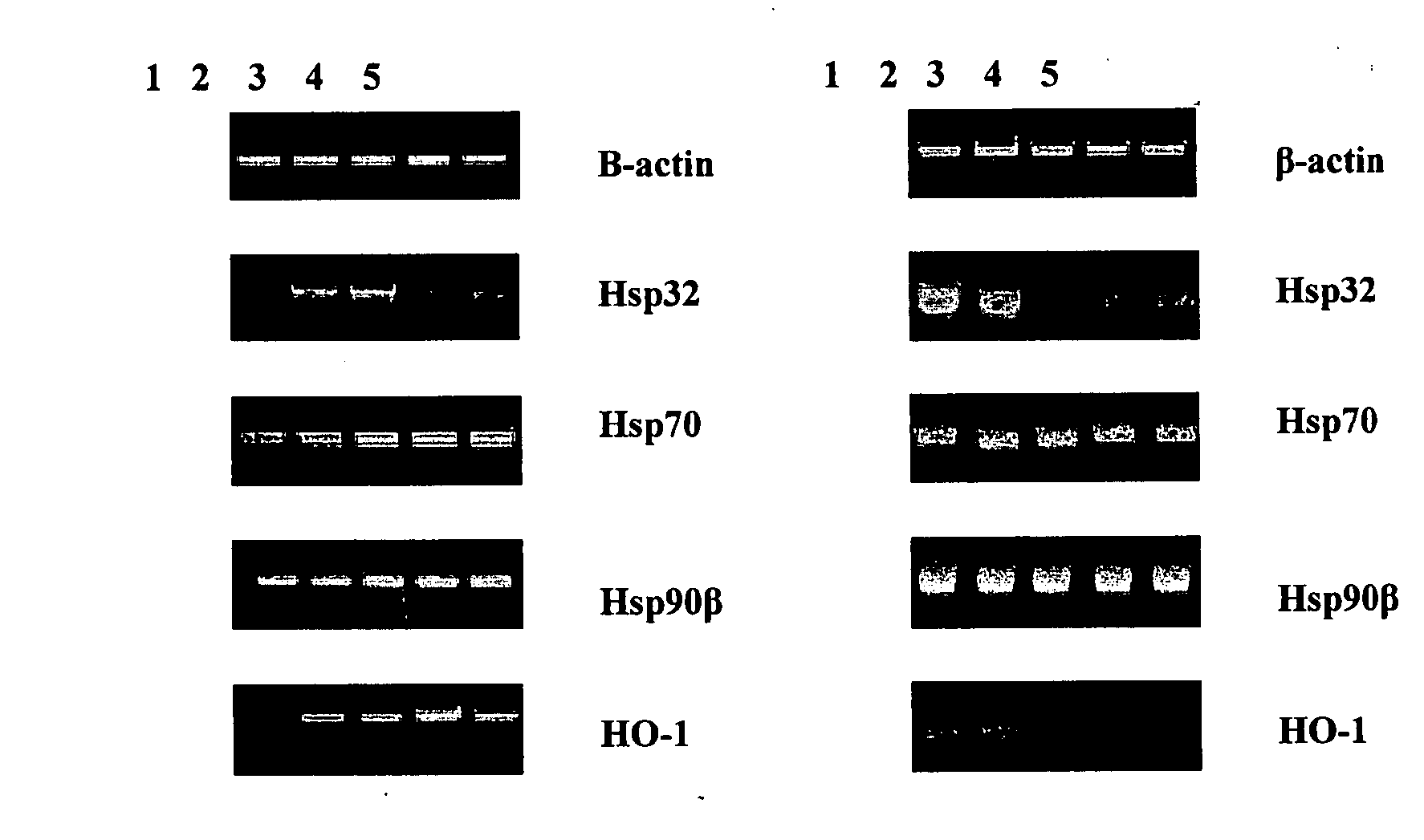 Pharmaceutical compositions and therapeutic applications for the use of a synthetic vitamin B12 derivative, glutathionylcobalamin