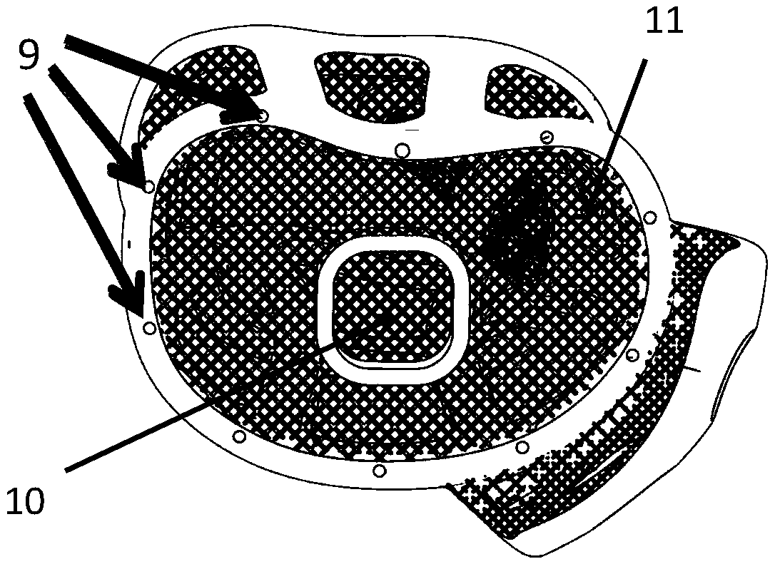 Spine prosthesis based on 3D printing and making method thereof