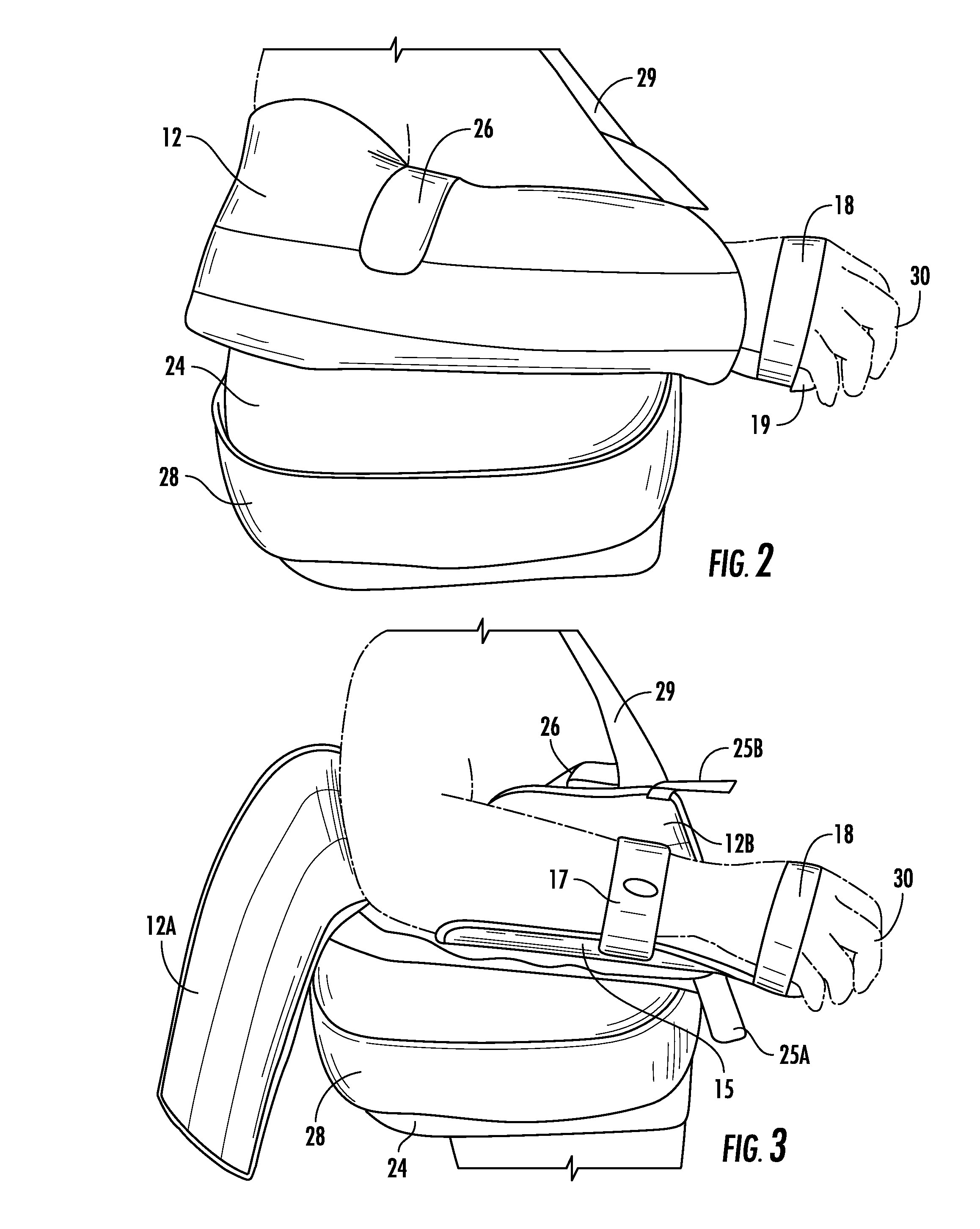 Shoulder and Arm Orthosis