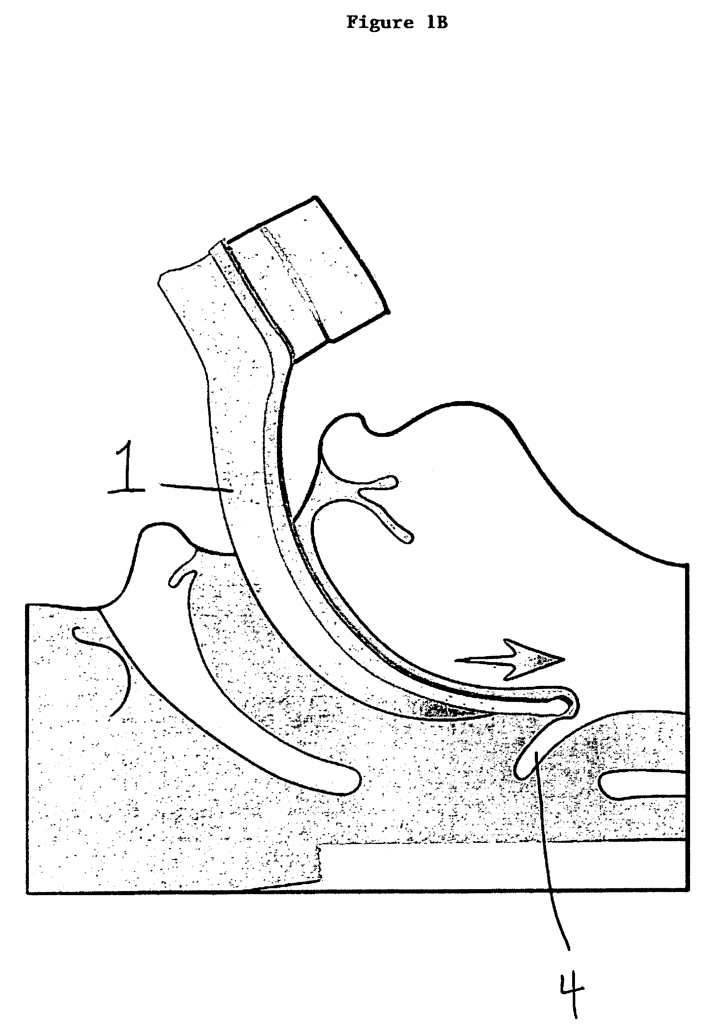 Apparatus for orotracheal intubation