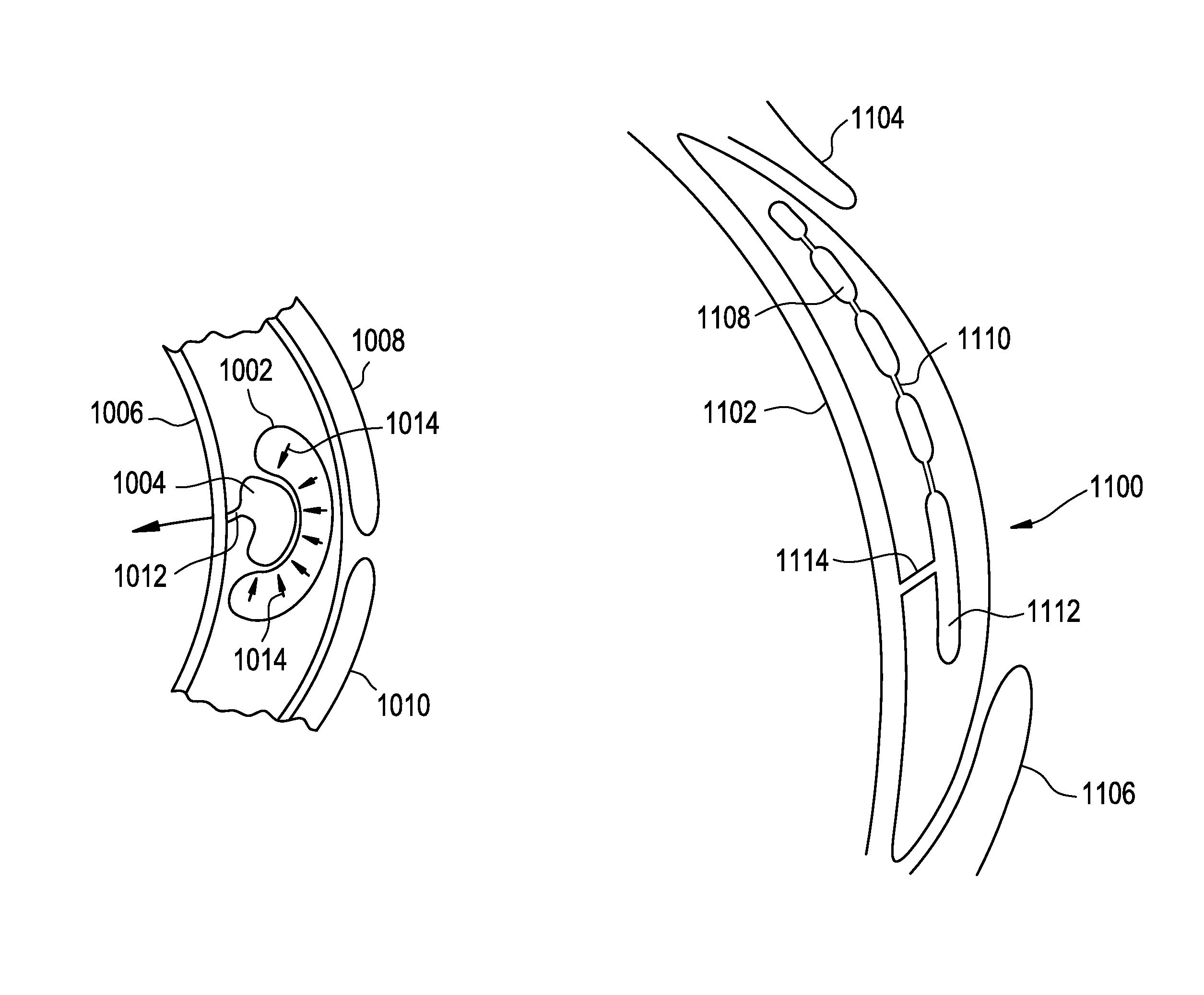 Dynamic fluid zones in contact lenses