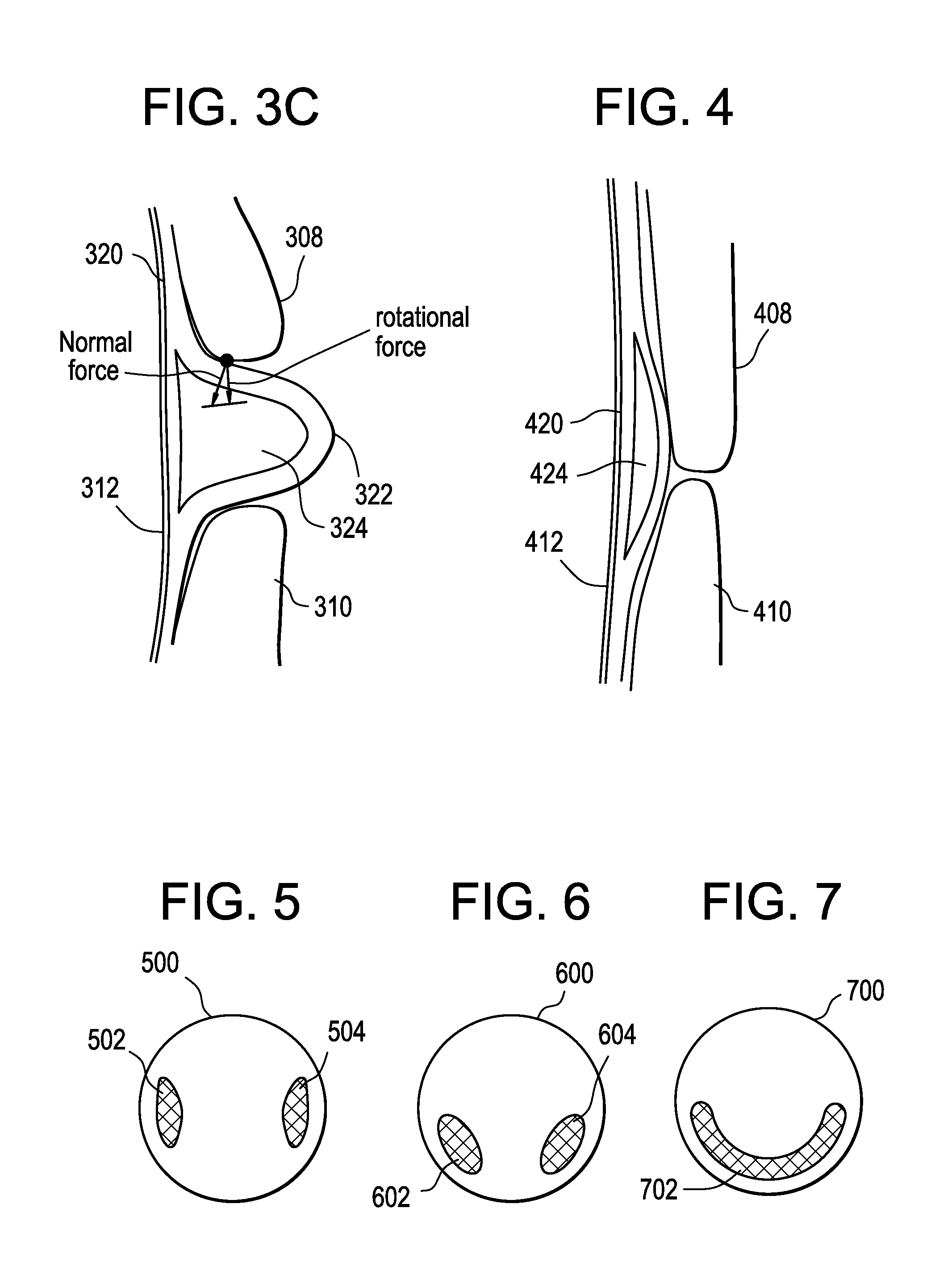 Dynamic fluid zones in contact lenses