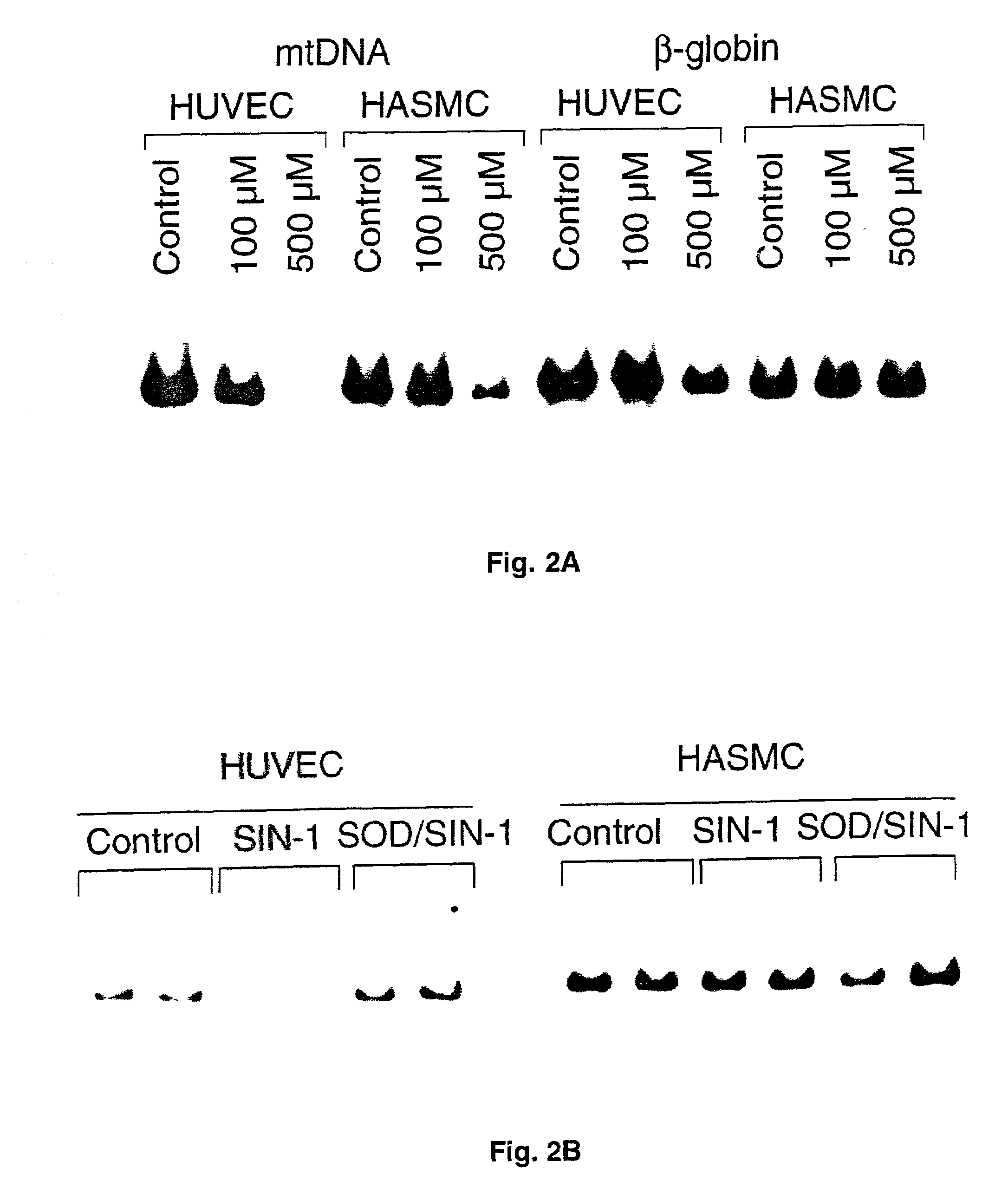 Mitochondrial DNA damage as a predictor of coronary atherosclerotic heart disease