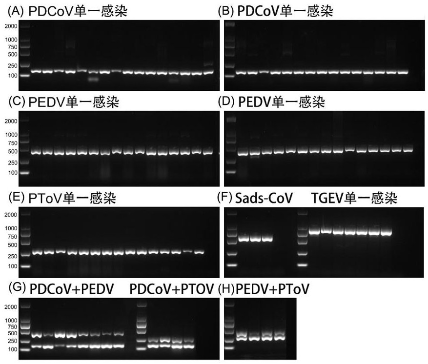 Quintuple RT-PCR detection method for the pathogen of porcine viral diarrhea