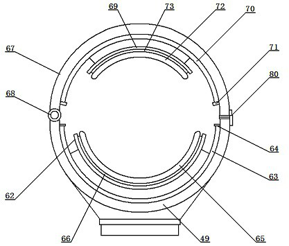 Sampling device for gynecological cervical disease inspection