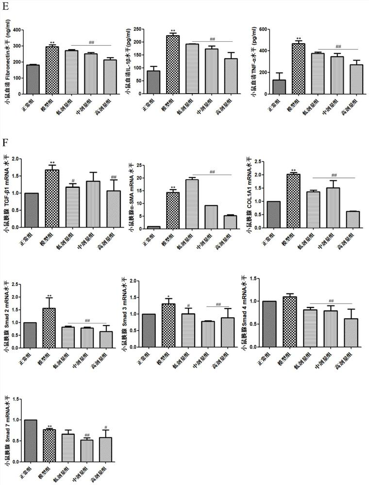 Application of sodium tanshinone IIA sulfonate in preparation of anti-pancreatic fibrosis medicine