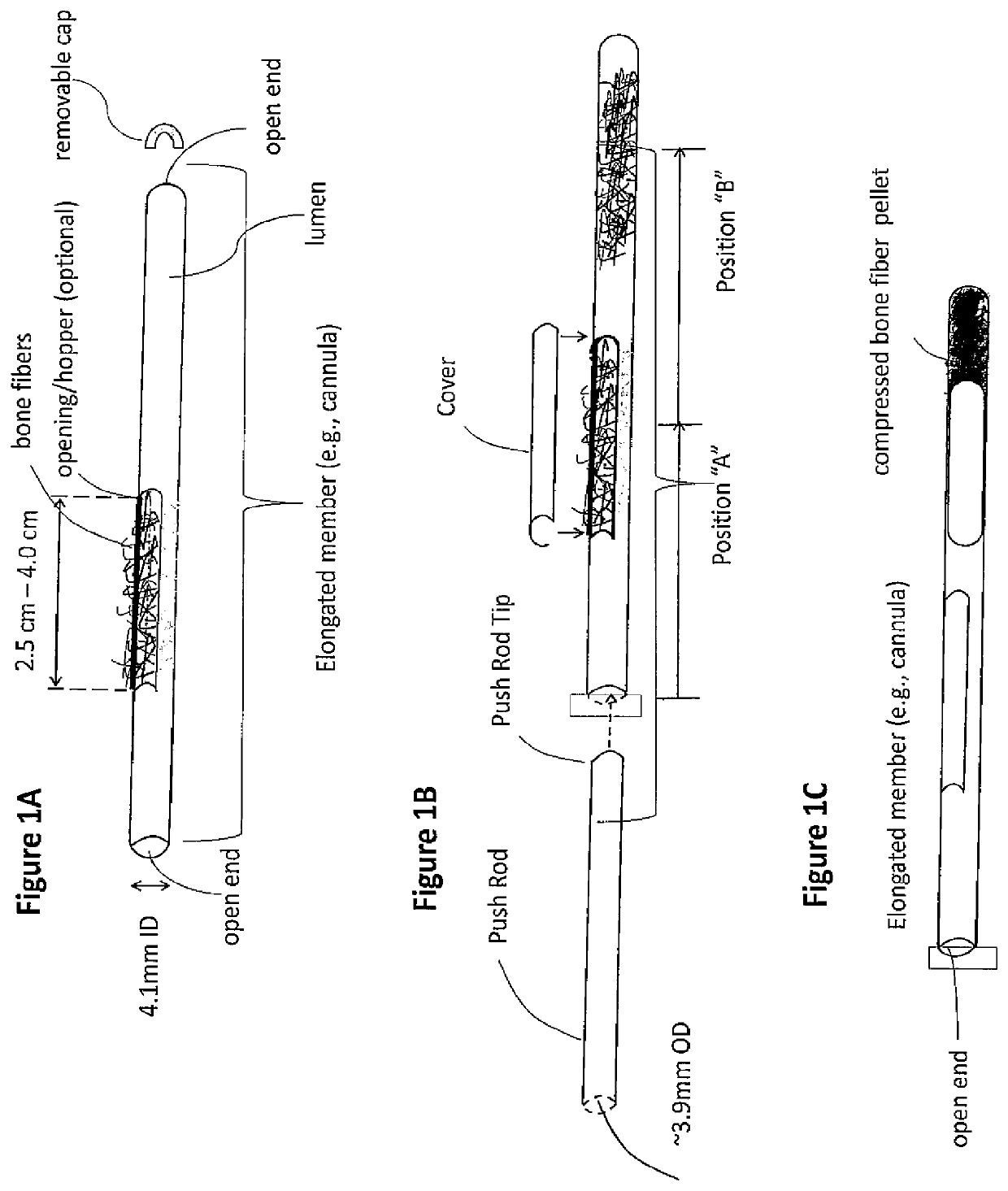 Demineralized bone fiber composition for use in minimally invasive surgery