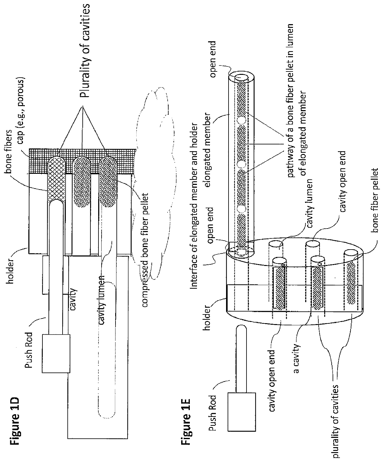 Demineralized bone fiber composition for use in minimally invasive surgery