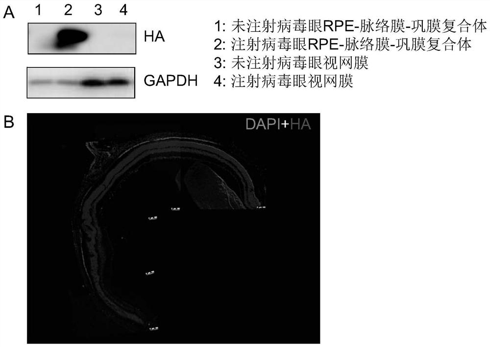 Construction method and application of retinitis pigmentosa animal model