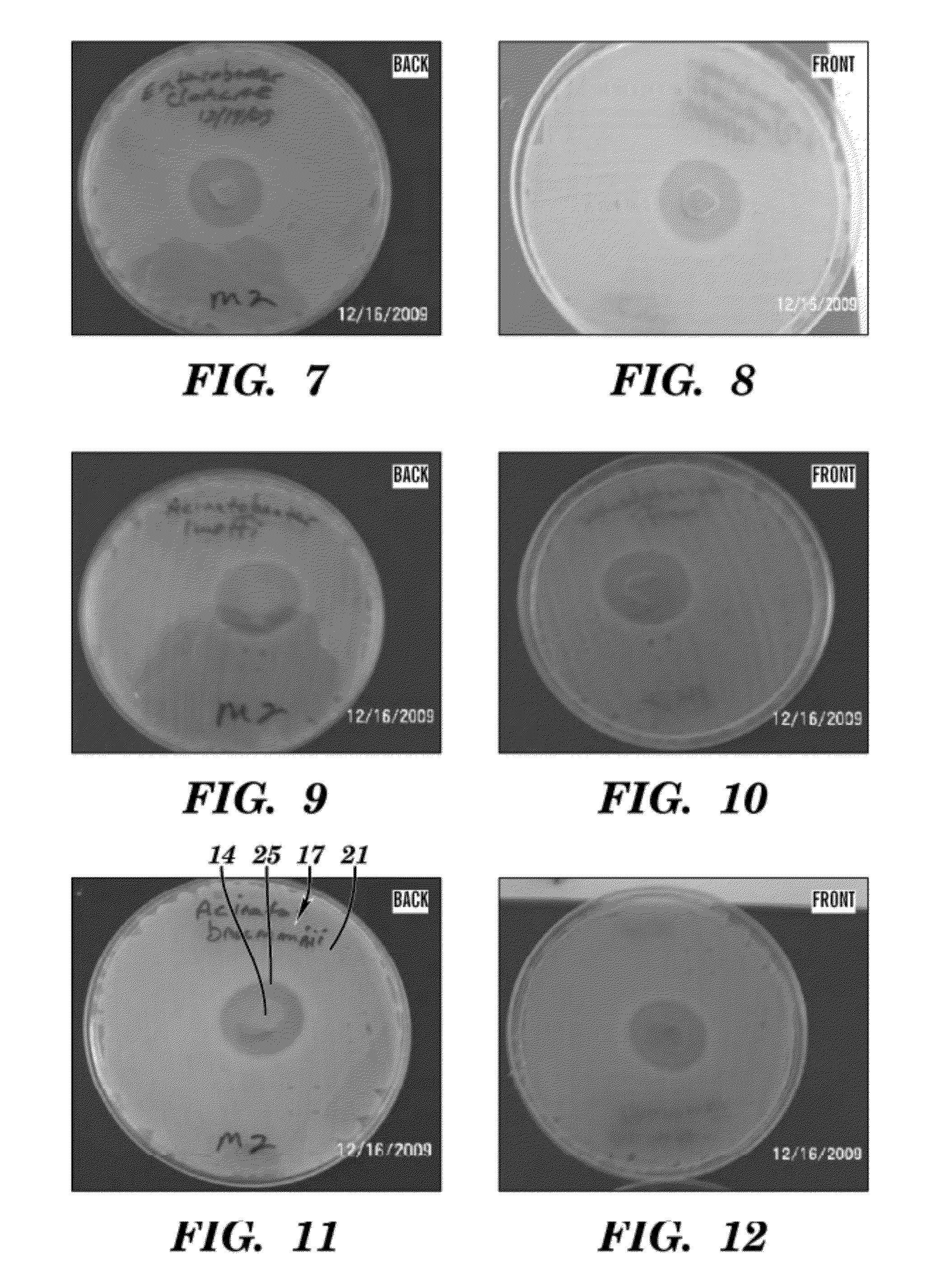 Topical drug delivery system with dual carriers