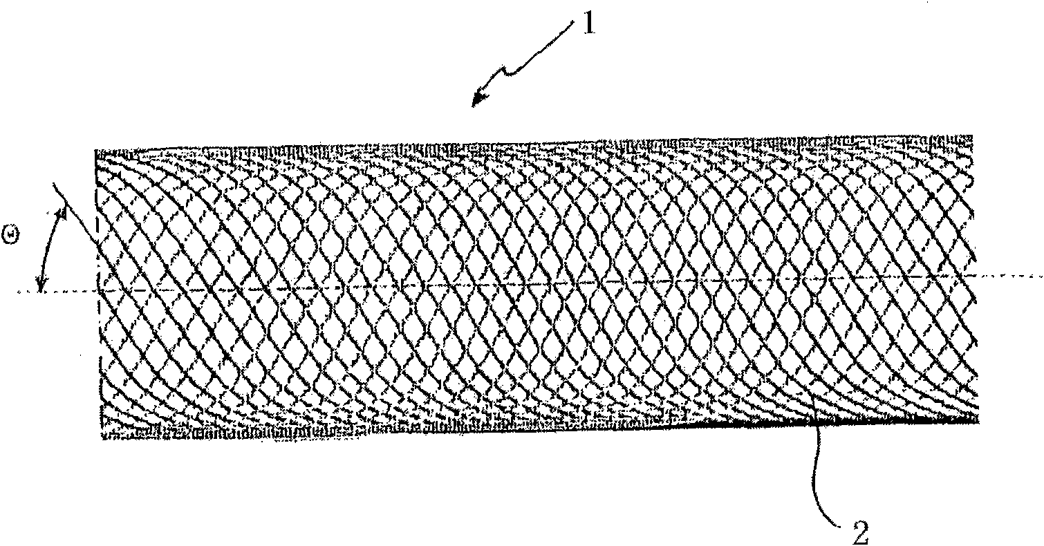 Implant for influencing blood flow