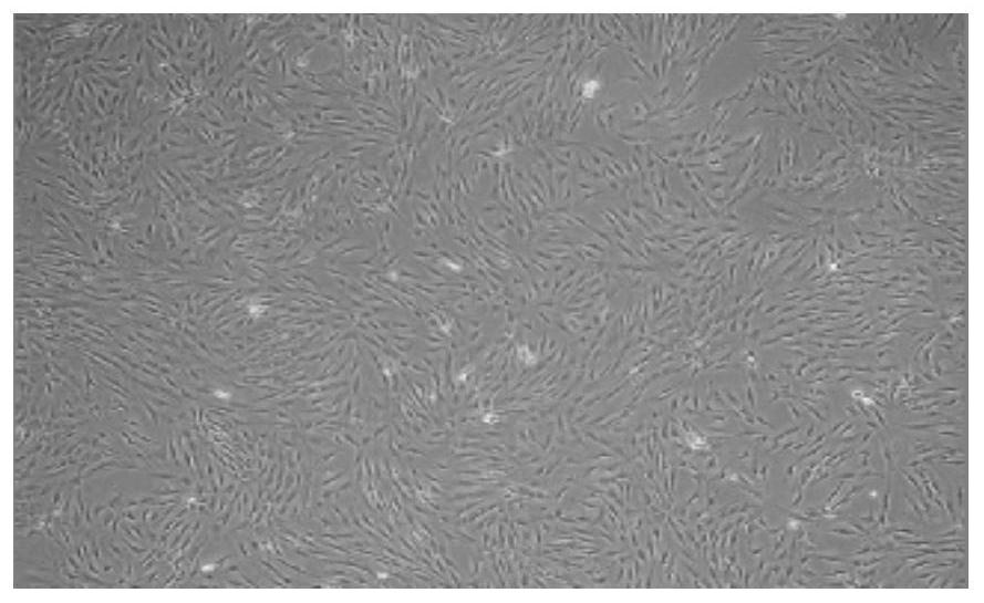 Method for culturing umbilical cord tissue mesenchymal cells