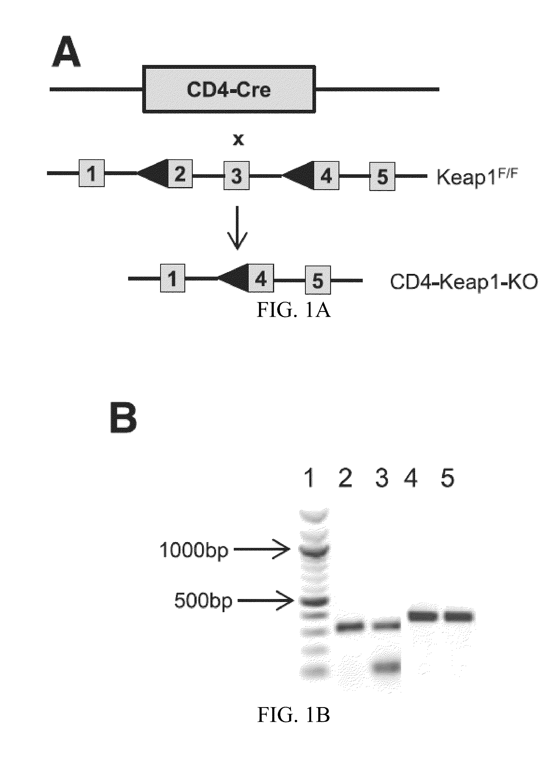 Compositions and methods for the study and treatment of acute kidney injury