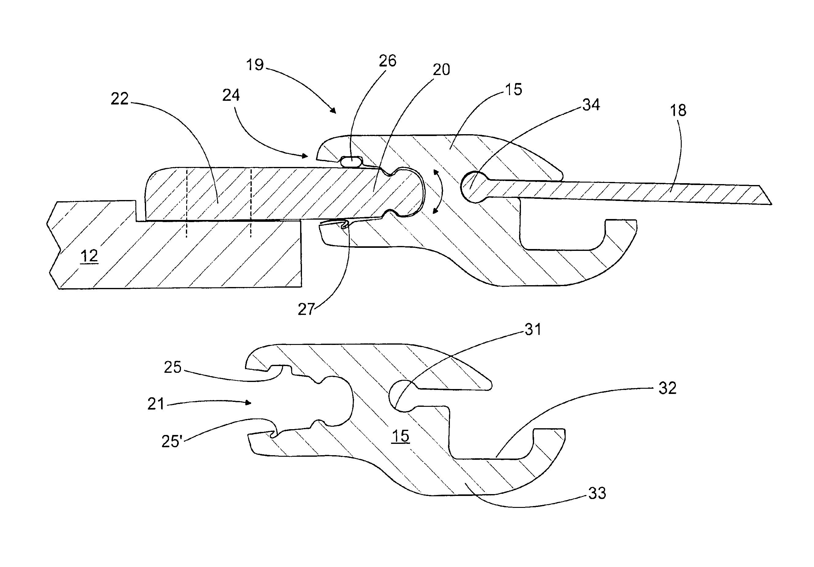 Treatment equipment