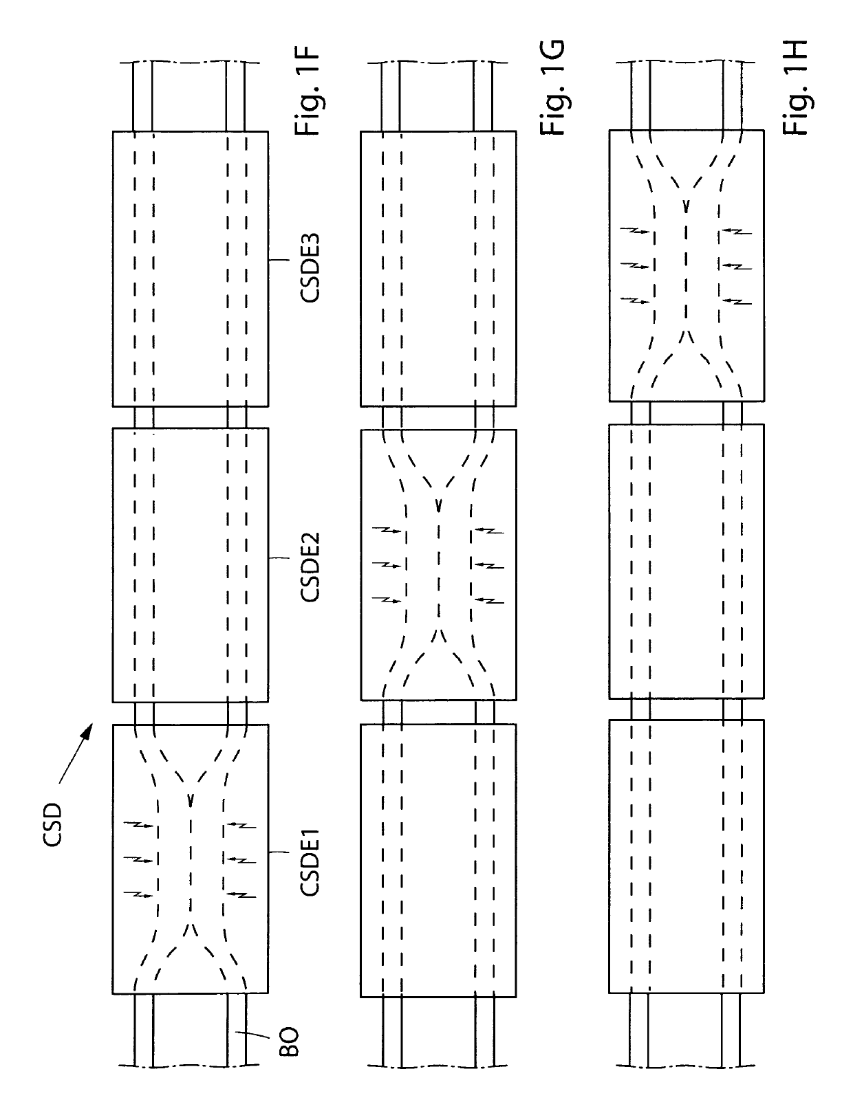 Method for controlling flow of urine in a patient's urethra, ureter, renal pelvis or bladder