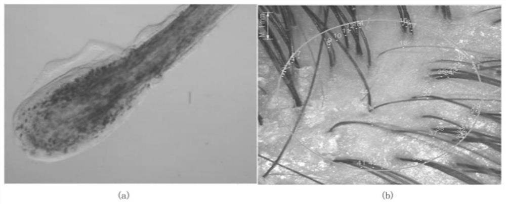 Essence with hair fixing and growing effects and preparation method thereof