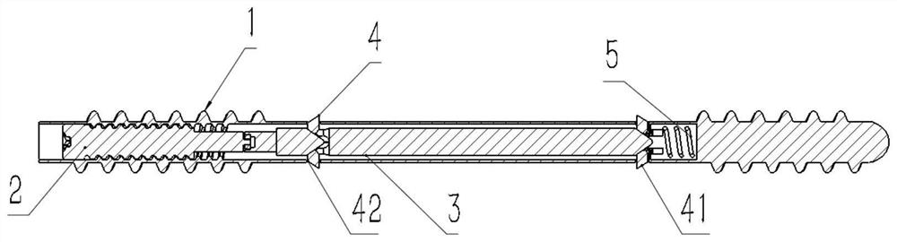 An anti-rotation orthopedic internal fixator