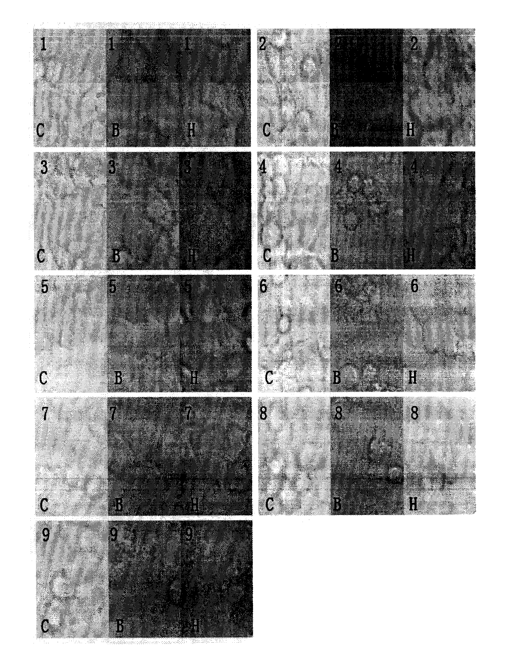 Application of human ribosomal protein L23 label peptide in preparation of anti-cancer medicines