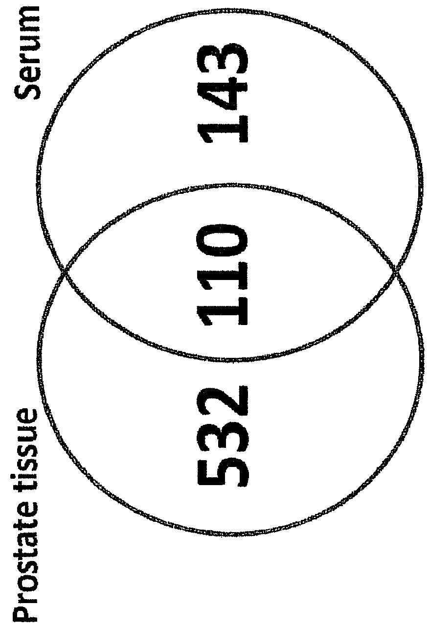 Method for biomarker and drug-target discovery for prostate cancer diagnosis and treatment as well as biomarker assays determined therewith