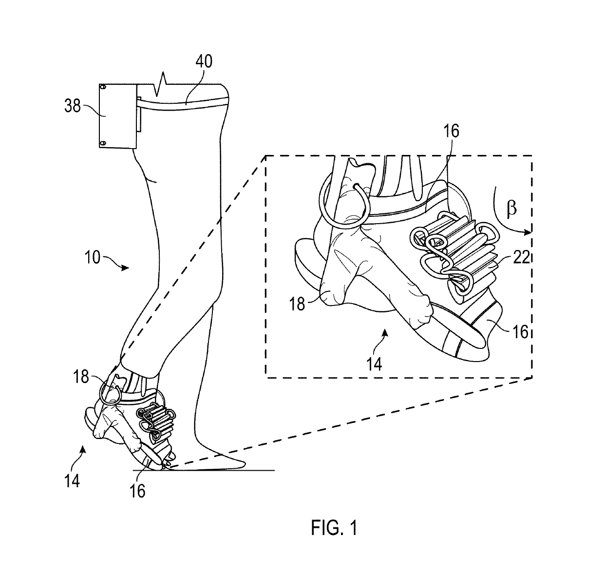 Soft dynamic ankle-foot orthosis exosuit for gait assistance with foot drop