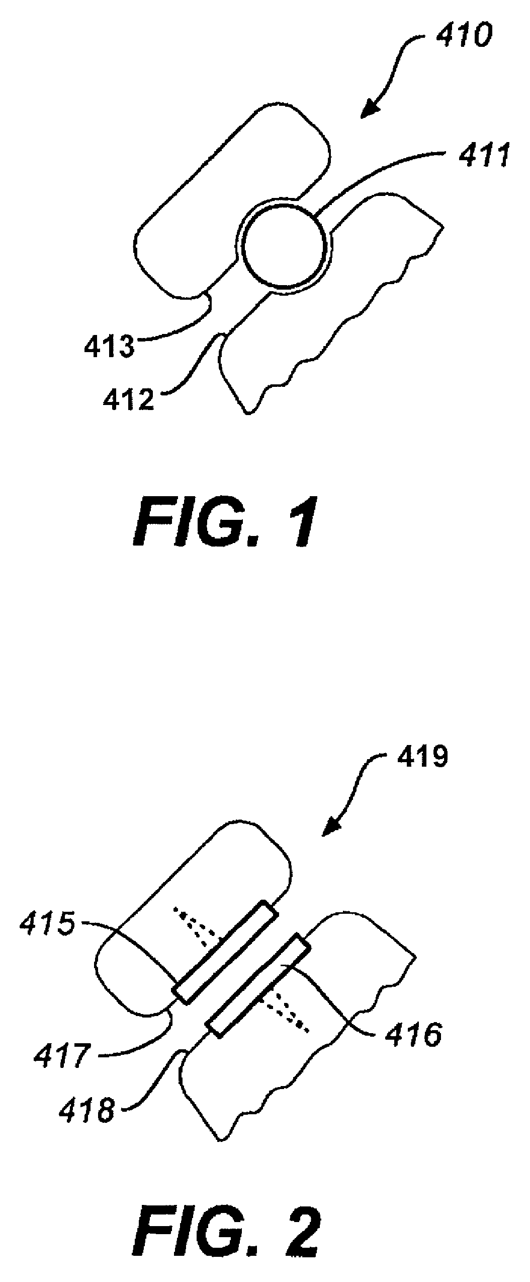 Facet device and method