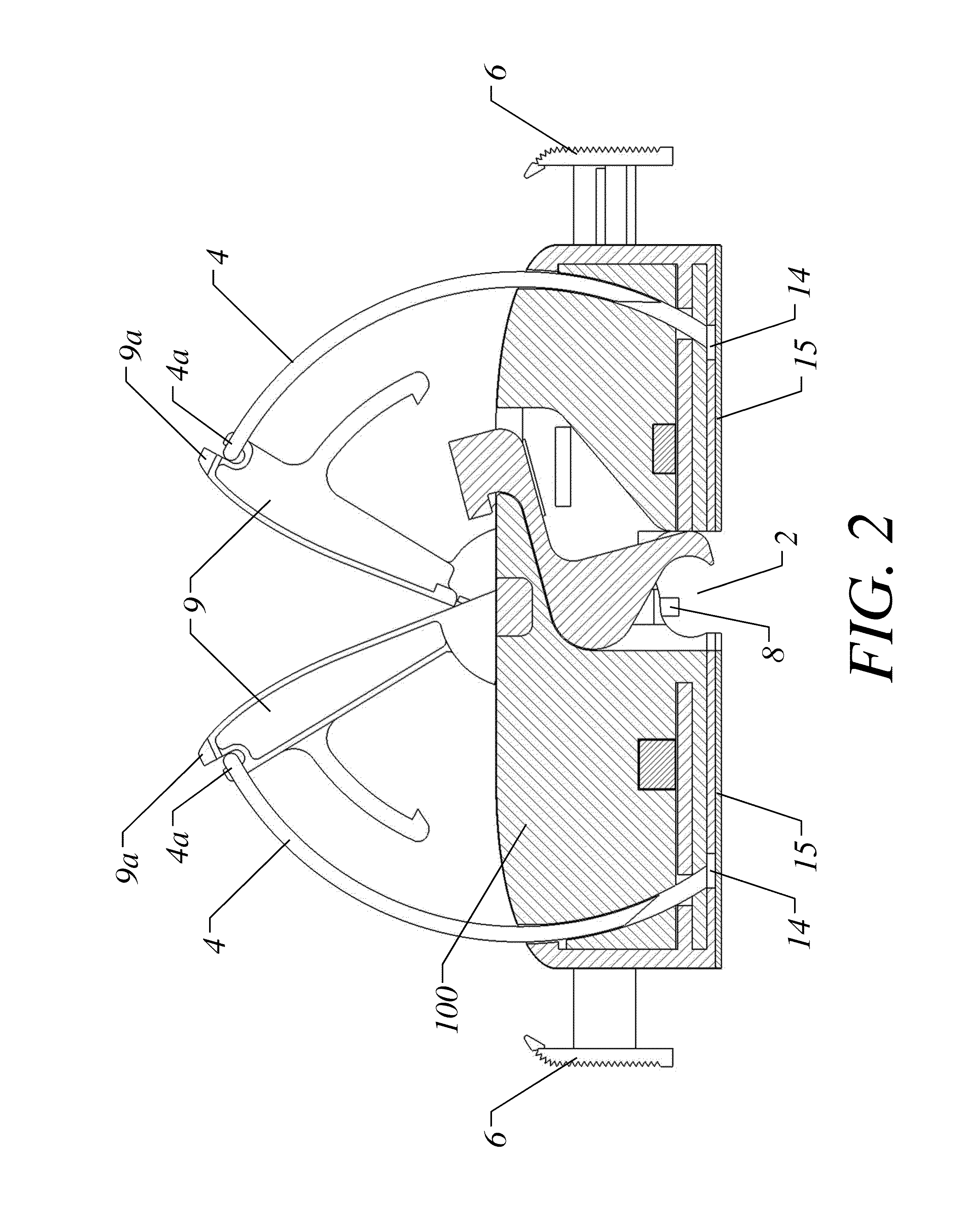 Catheter anchoring device and method