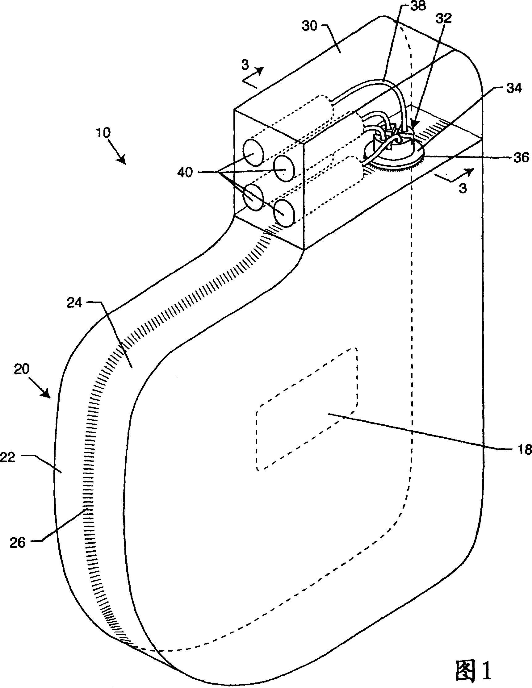 Magnetic shielding aimd housing equipped with window for magnetic actuation type switch