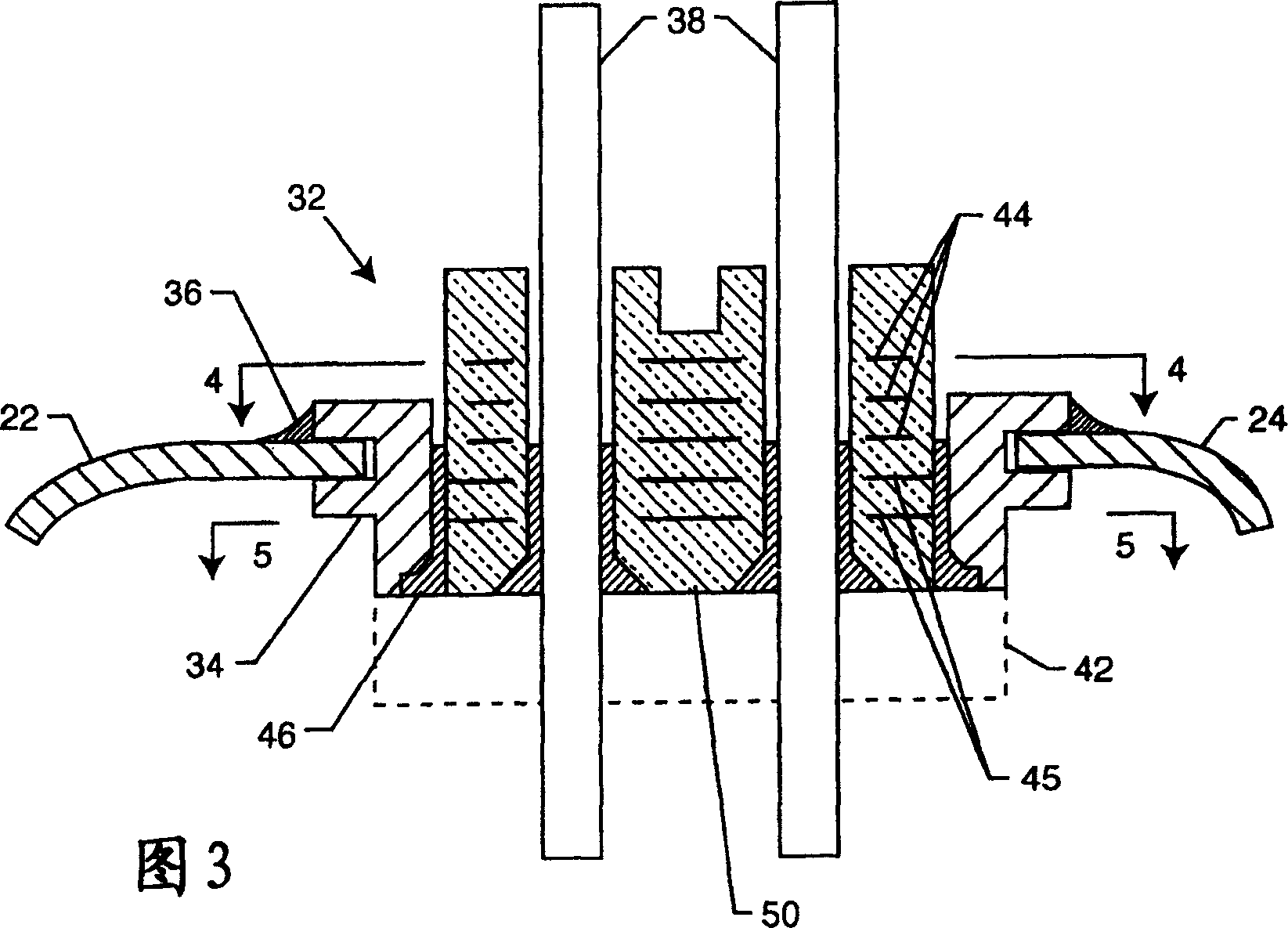 Magnetic shielding aimd housing equipped with window for magnetic actuation type switch