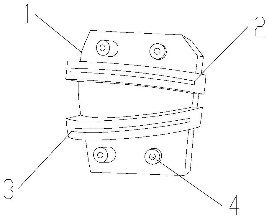 Knee joint introversion and extroversion osteotomy orthopedic guide plate and manufacturing method thereof