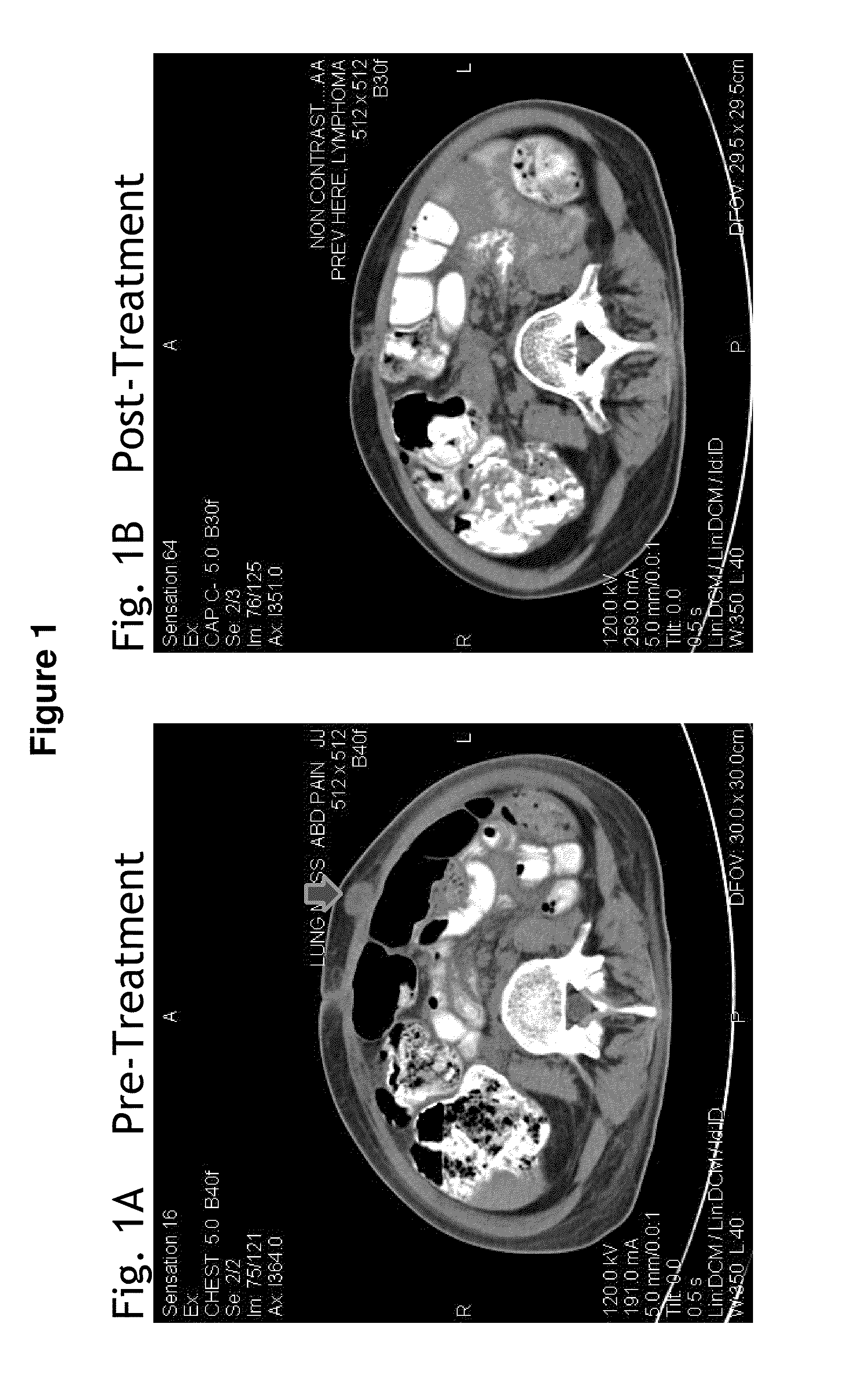 Methods for treating viral disorders