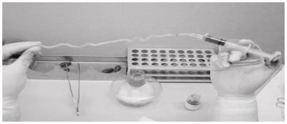 Application of umbilical artery in preparation of graft blood vessel material for coronary artery bypass grafting and method for preparing graft blood vessel material for coronary artery bypass grafting