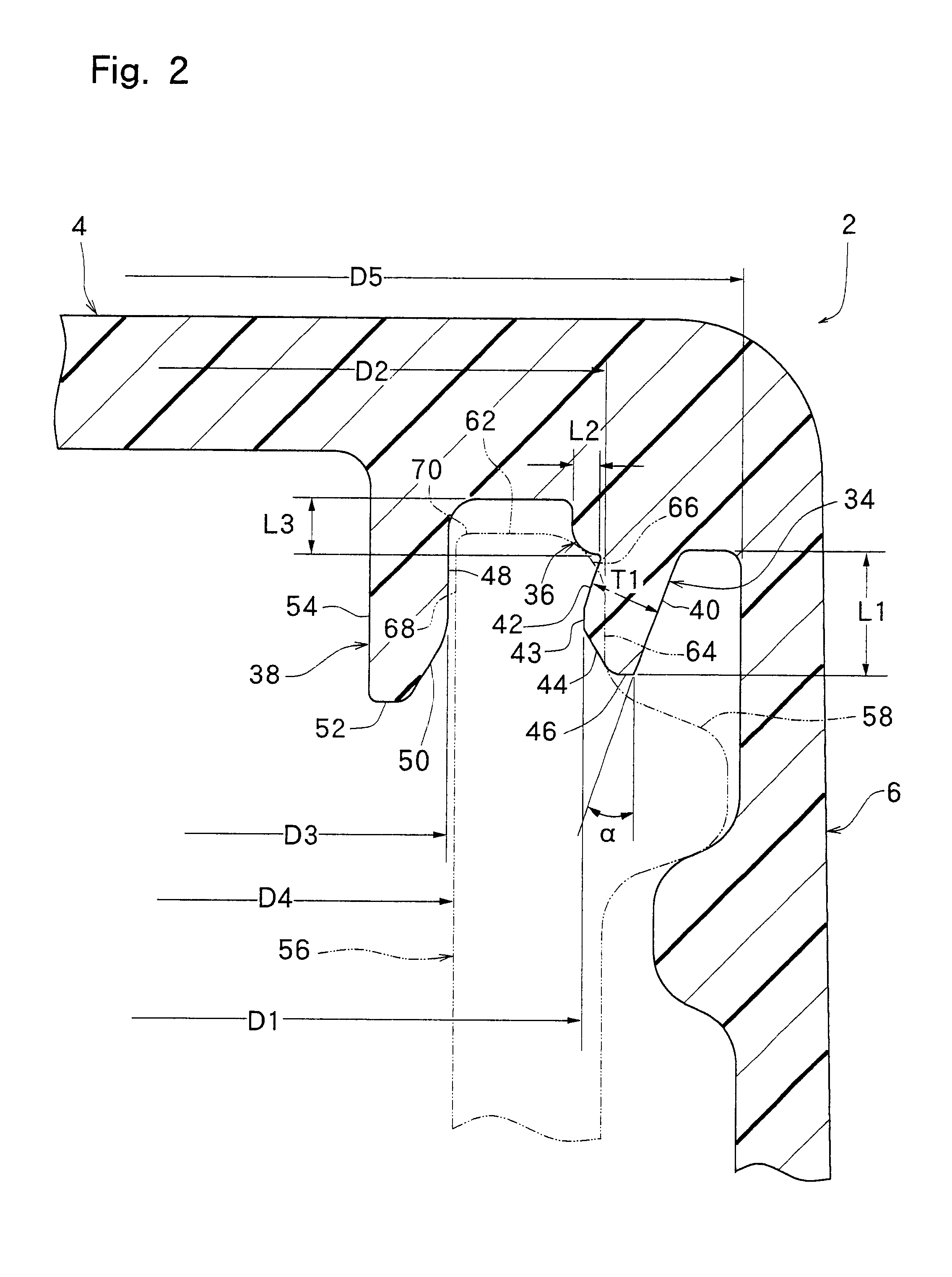 Plastic container closure