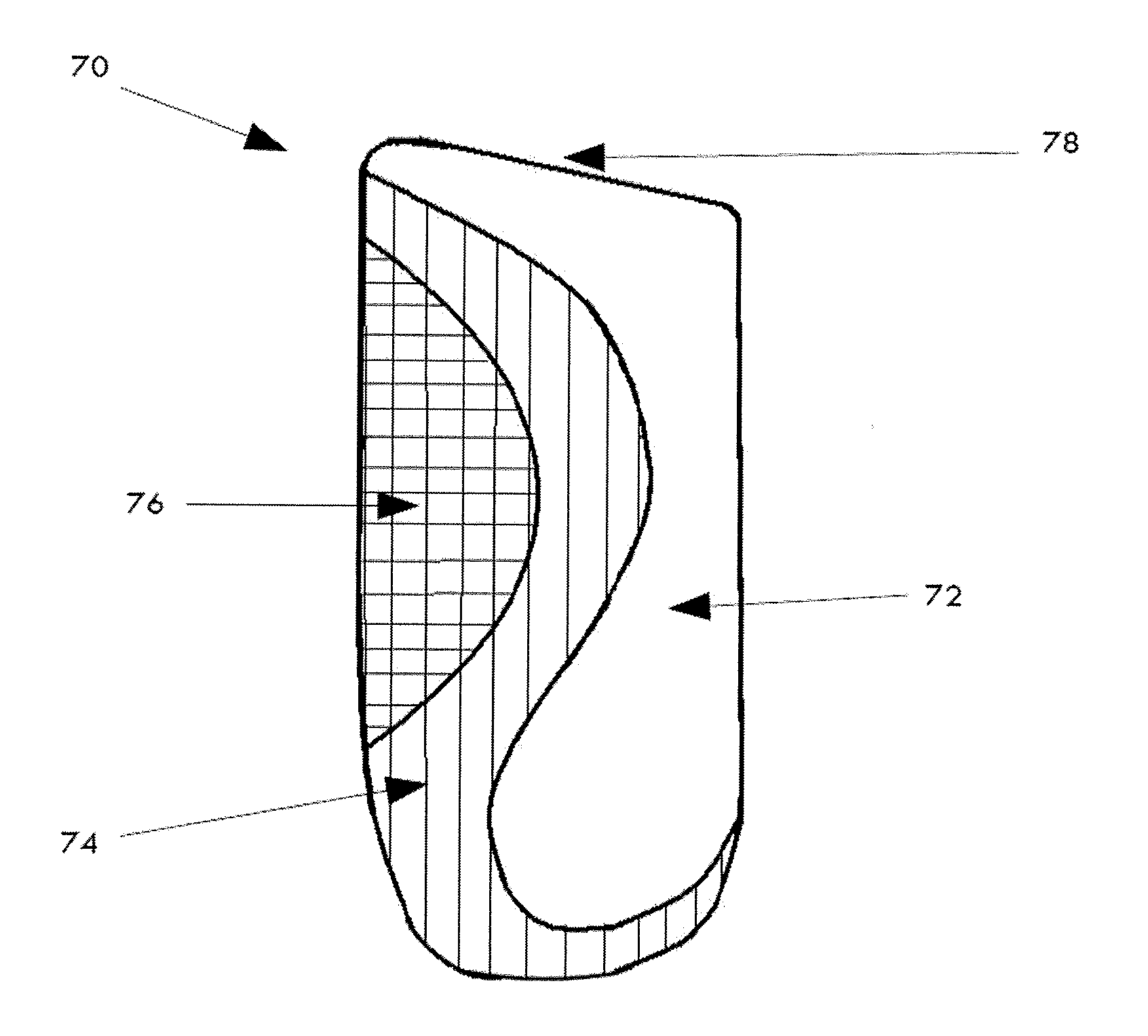 Orthotic Device and Method of Manufacture