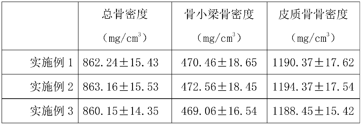 Eldecalcitol soft capsule and preparation method thereof