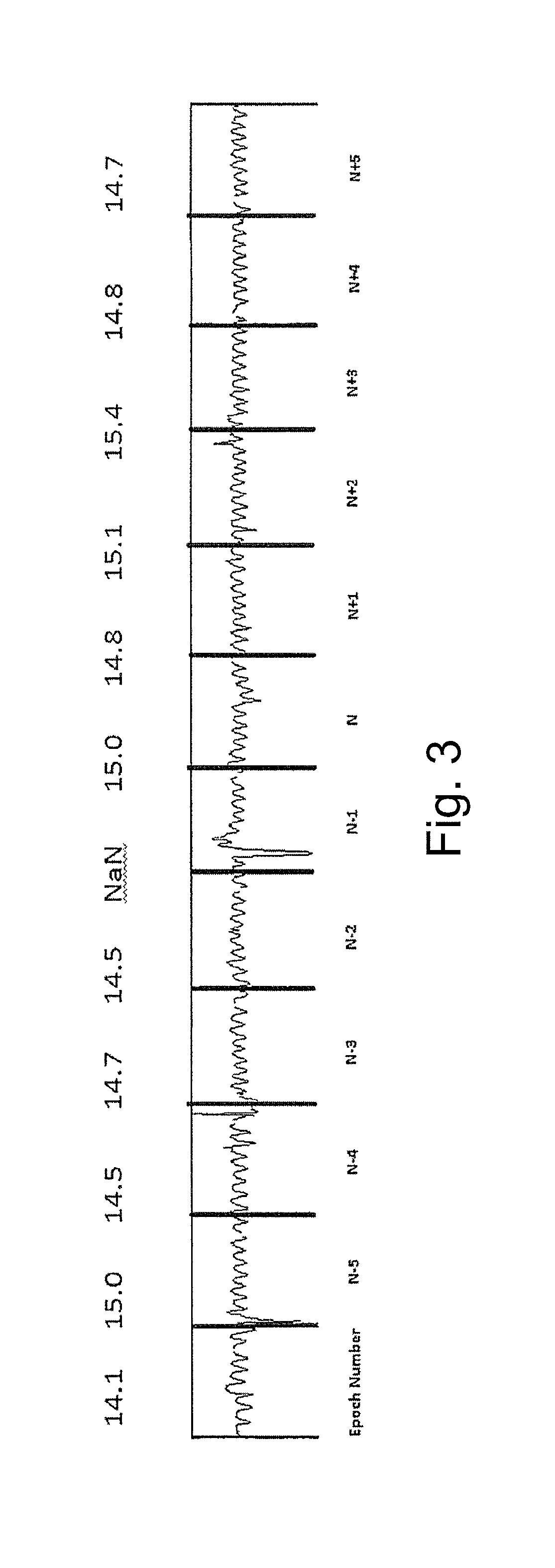 System and method for determining sleep stage