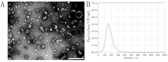 Exosome drug delivery system and preparation method and application thereof