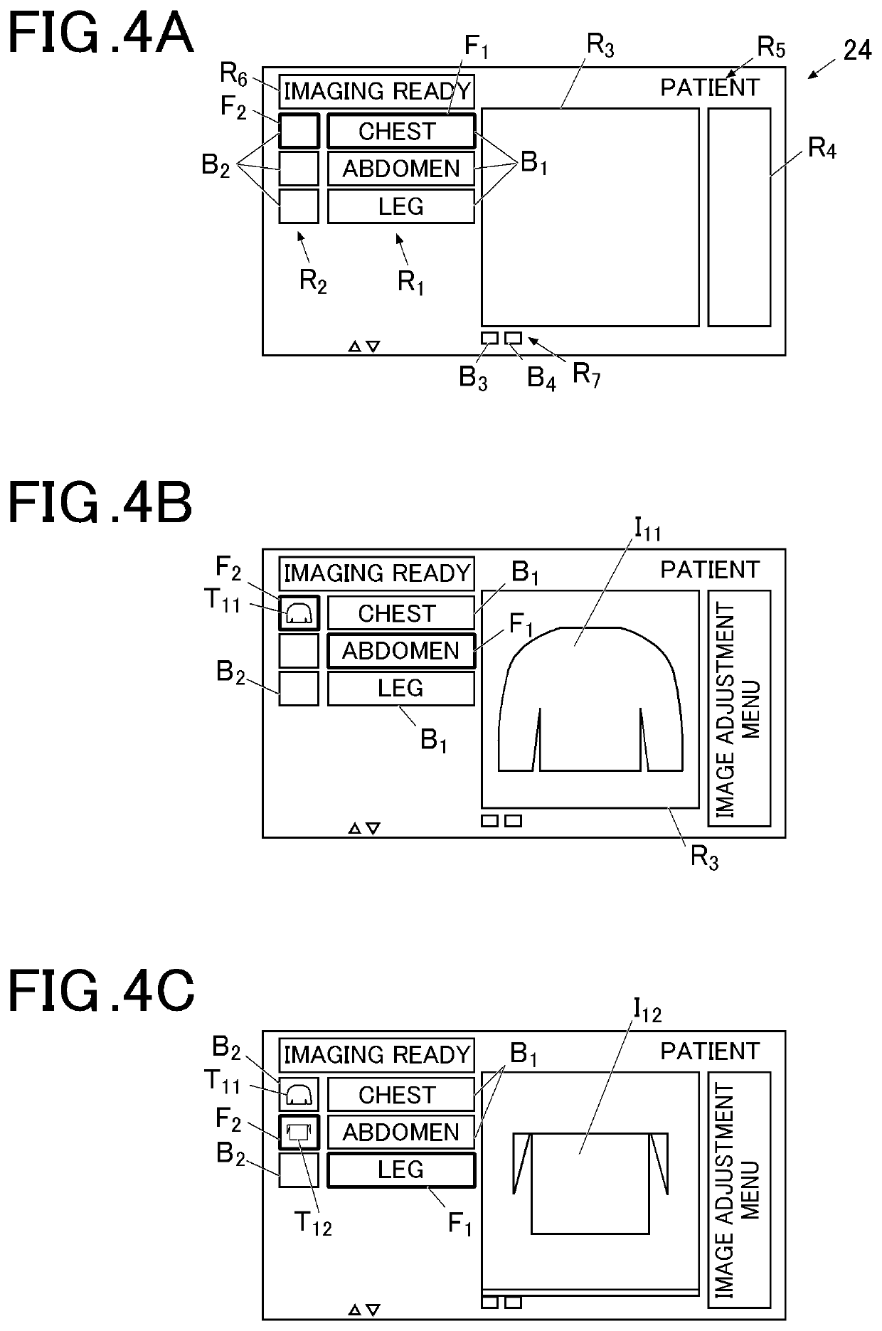 Radiographic image display device, radiographic image display method, and storage medium