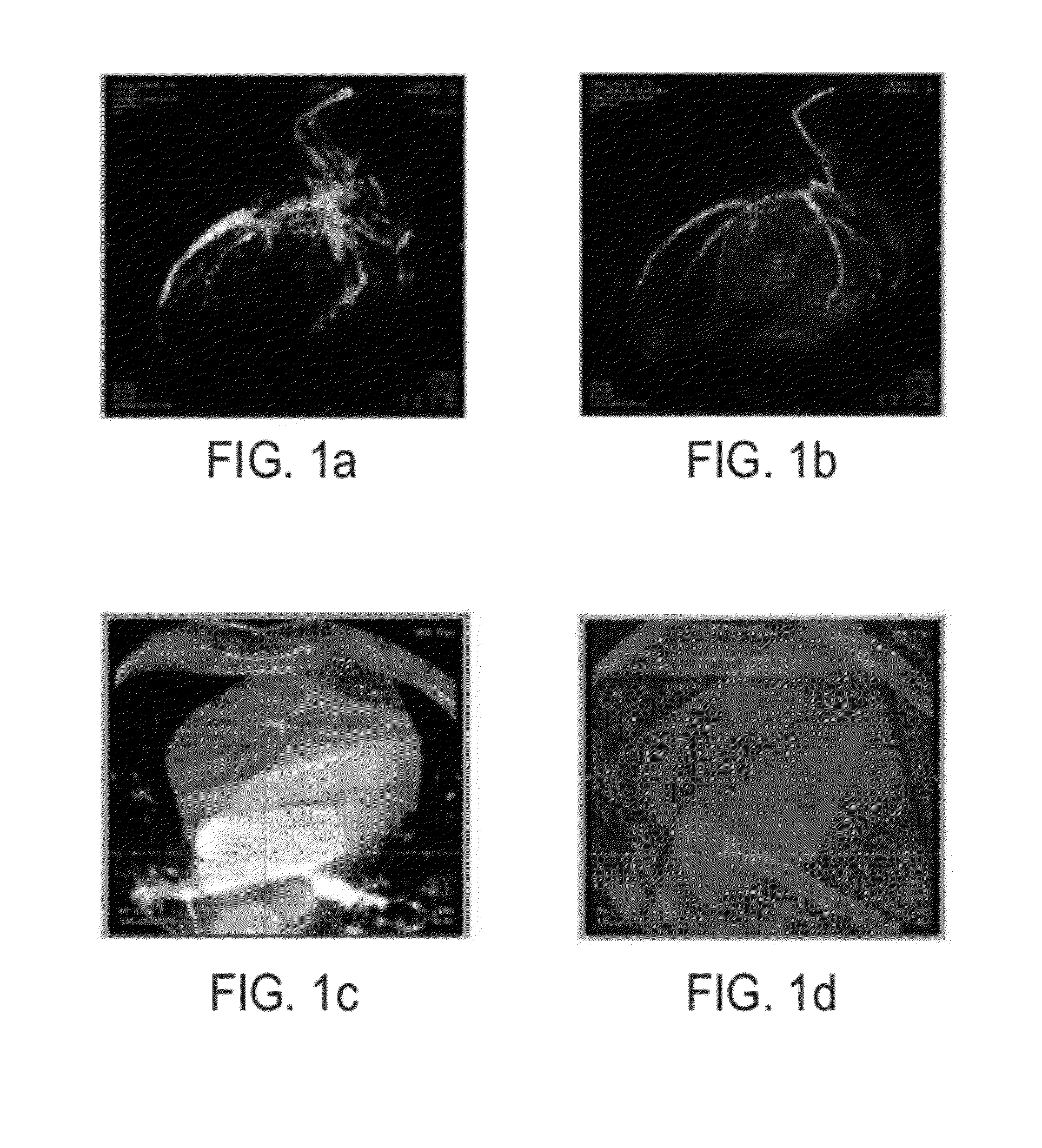 Method and System for 3D Cardiac Motion Estimation from Single Scan of C-Arm Angiography