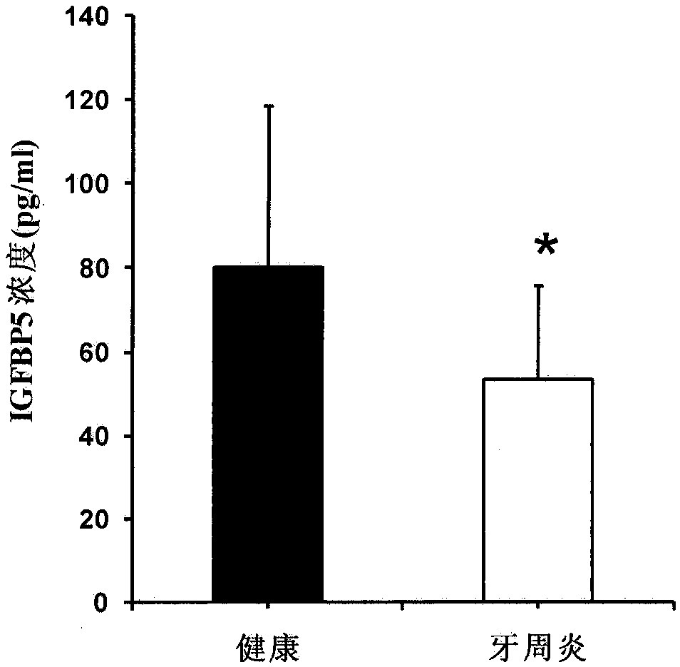 Application of insulin-like growth factor binding protein 5 in promoting periodontal tissue regeneration