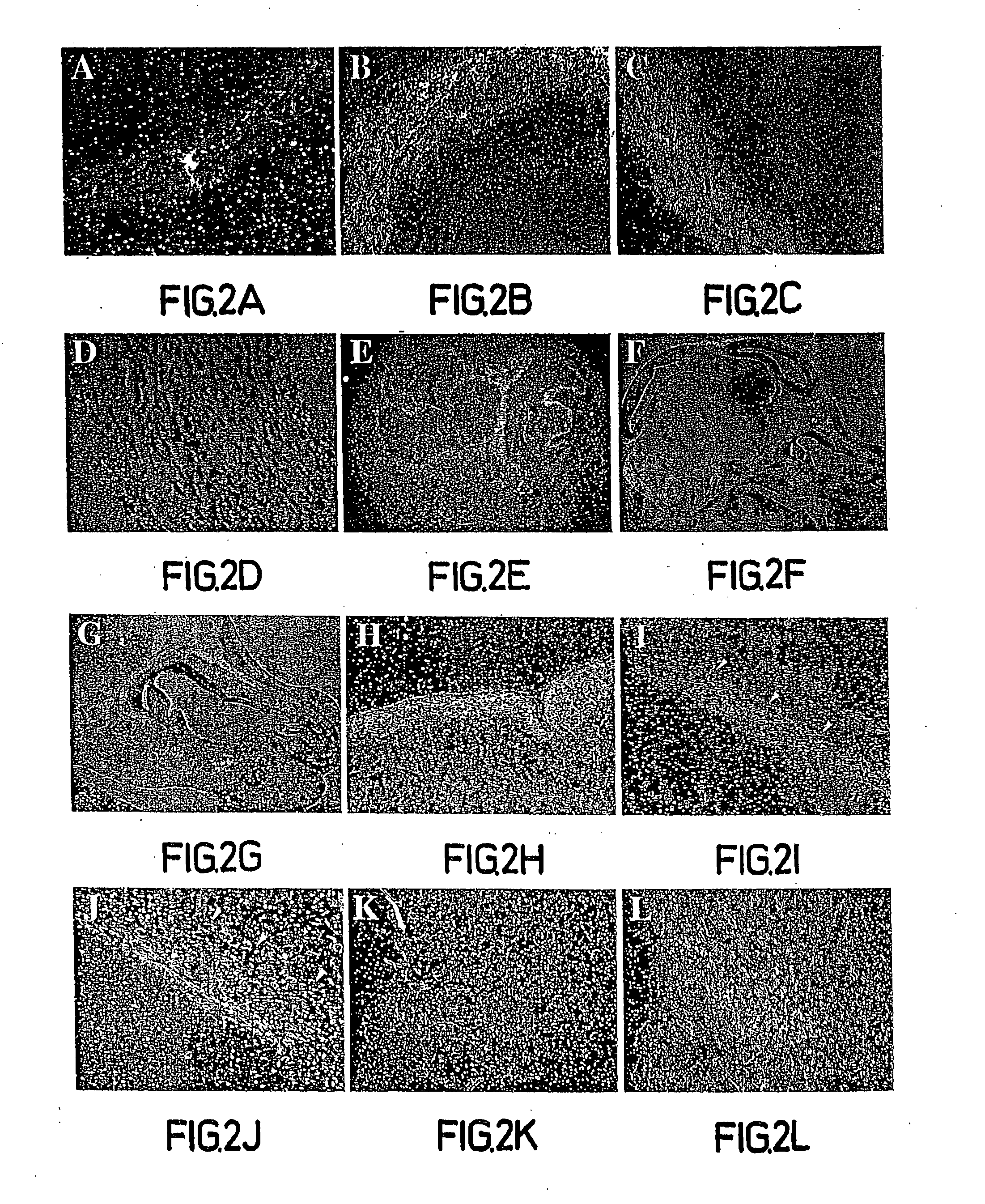 Compositions, methods and kits relating to CTHRC1, a novel modulator of collagen matrix