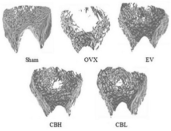 Application and pharmaceutical composition of the extract of yin xiang leaf as preparation of medicine for treating osteoporosis