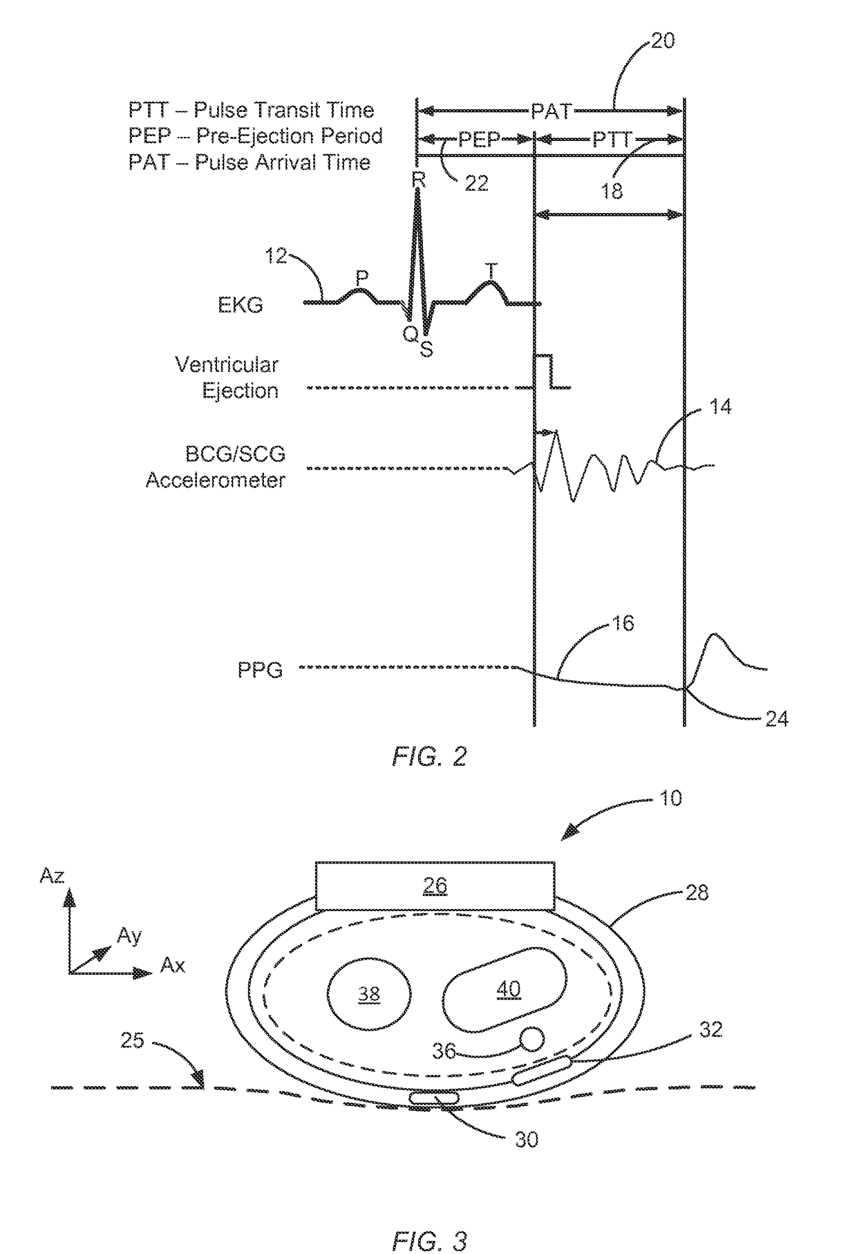 Wrist worn accelerometer for pulse transit time (PTT) measurements of blood pressure