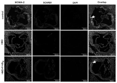 Molecular marker for diagnosing atherosclerosis and application of marker