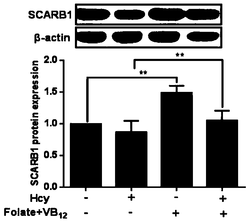 Molecular marker for diagnosing atherosclerosis and application of marker