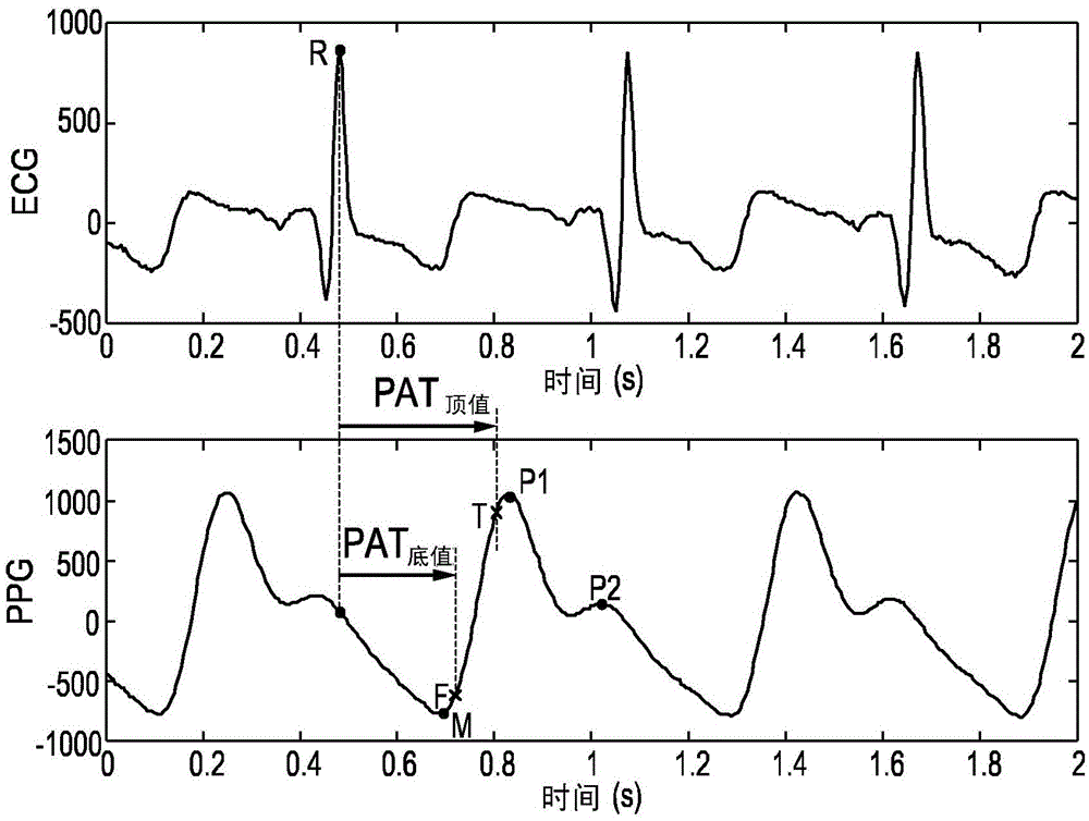 Monitoring system and method for monitoring the hemodynamic status of a subject