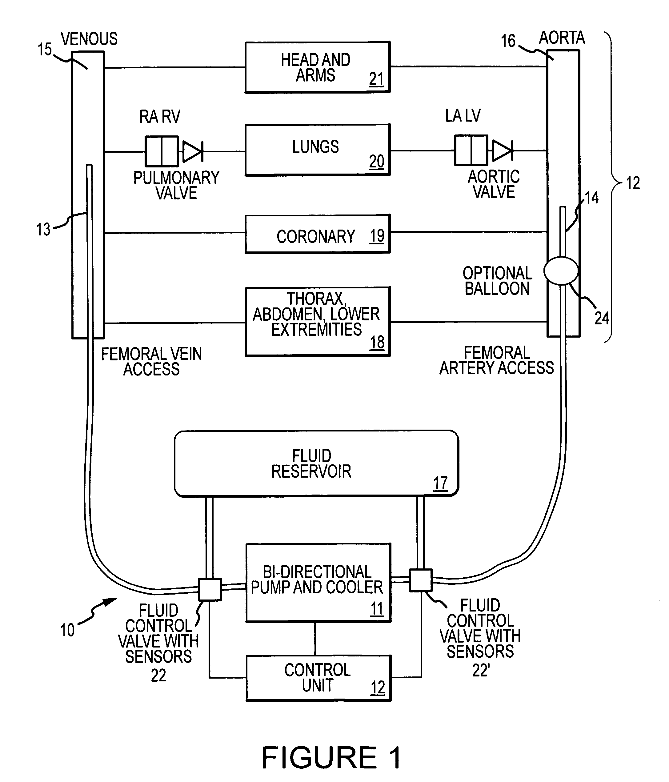 Cardiopulmonary bypass devices and methods