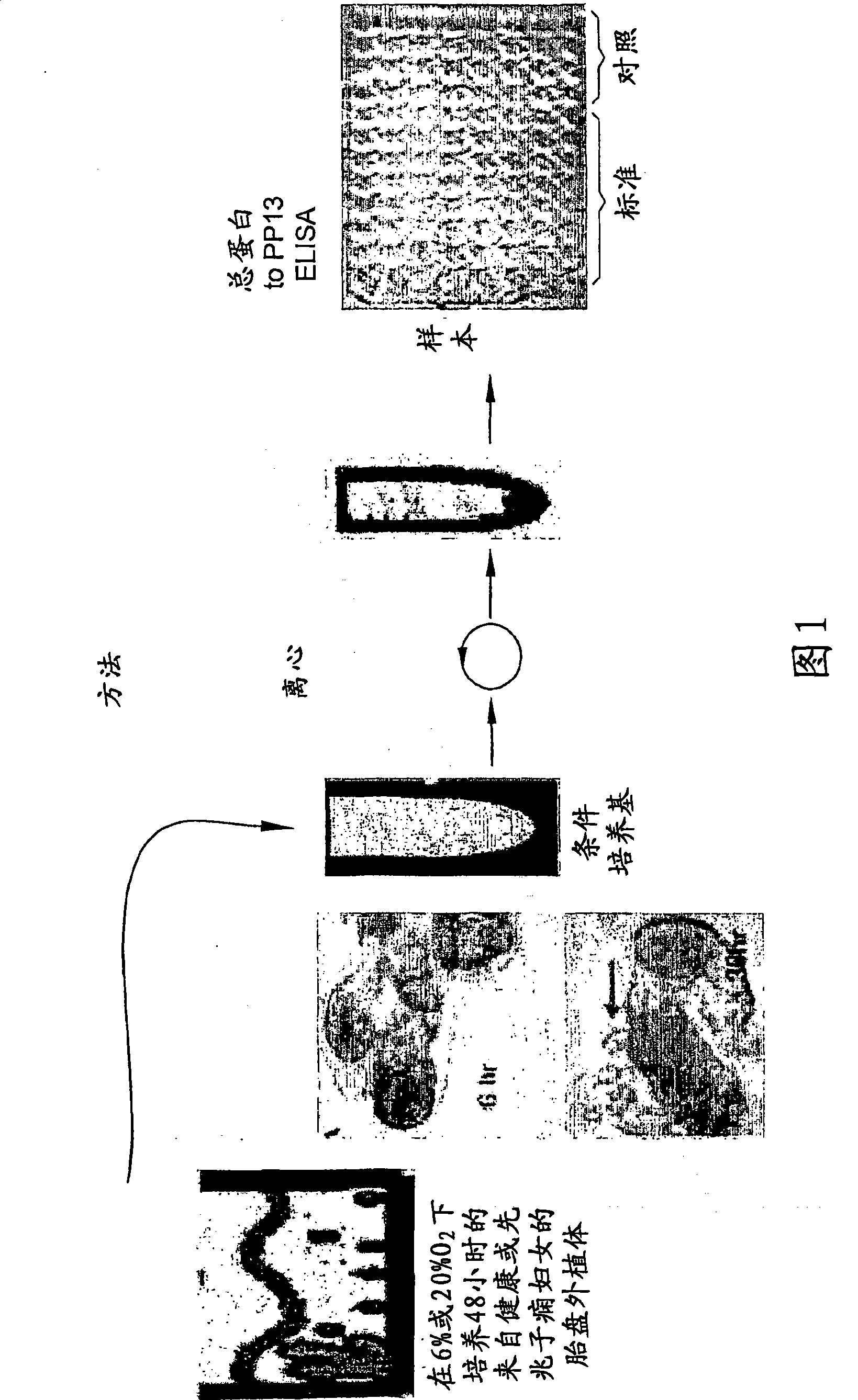 Method for determining the effectiveness of a treatment for preeclampsia