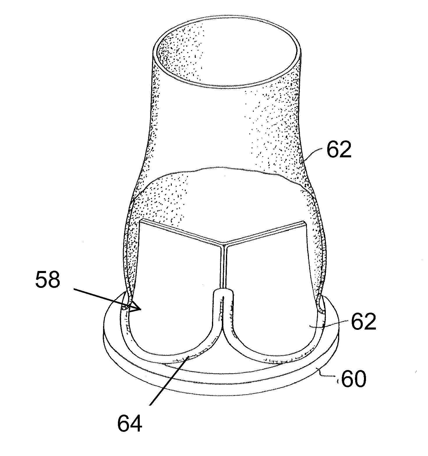 Pre-assembled bioprosthetic valve and sealed conduit