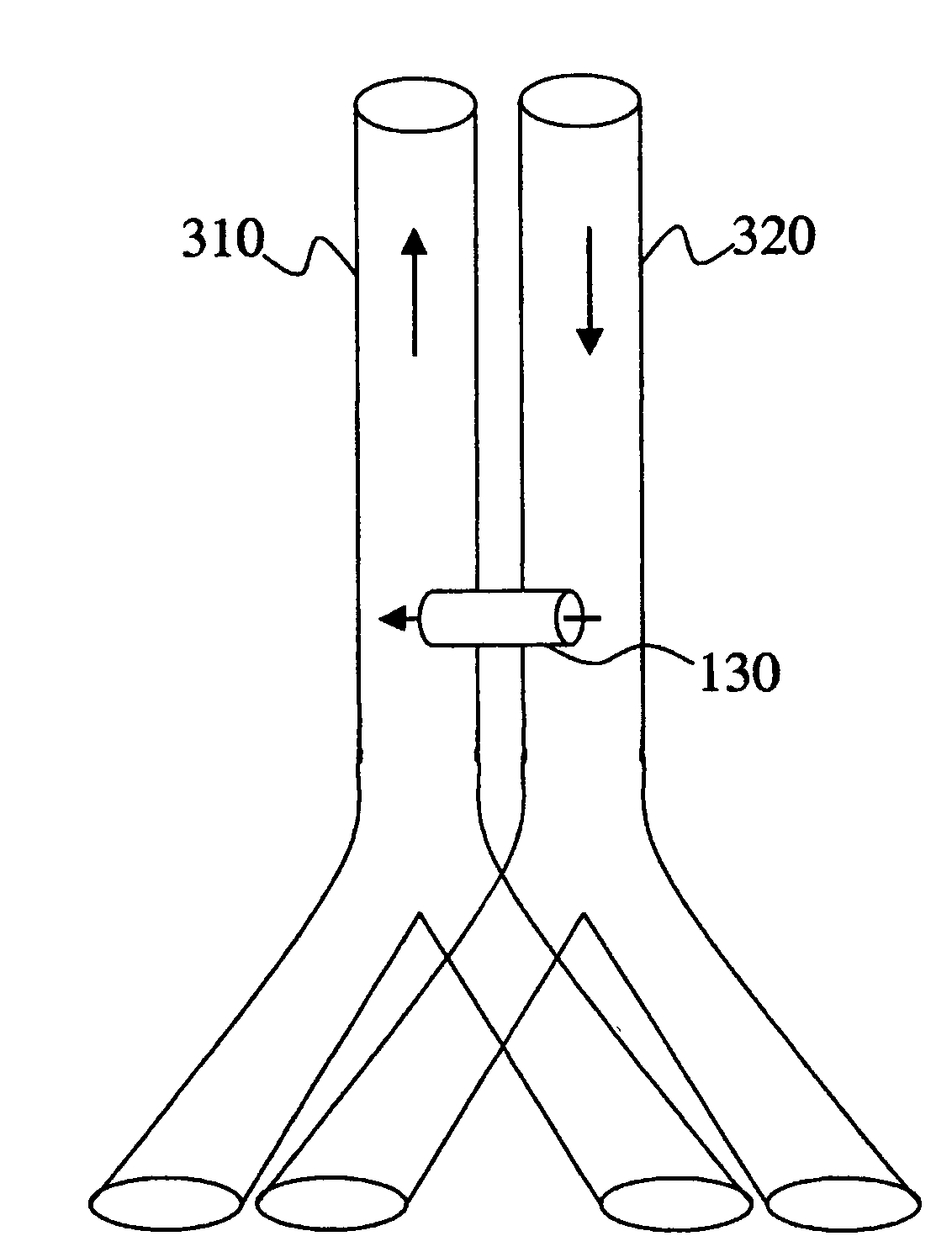 Arterio-venous shunt devices