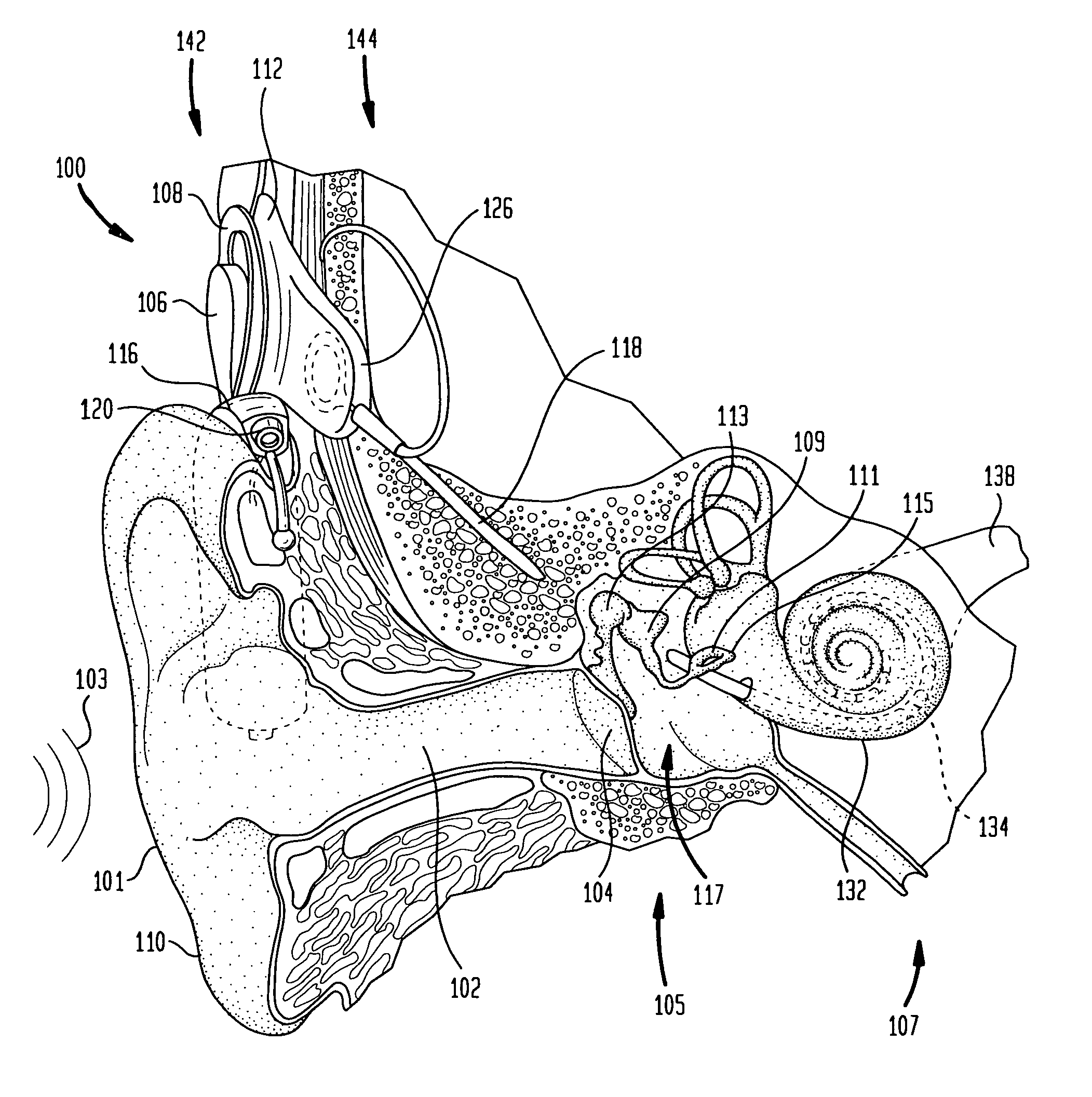 Independent and concurrent processing multiple audio input signals in a prosthetic hearing implant